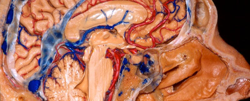 Image of the brain 