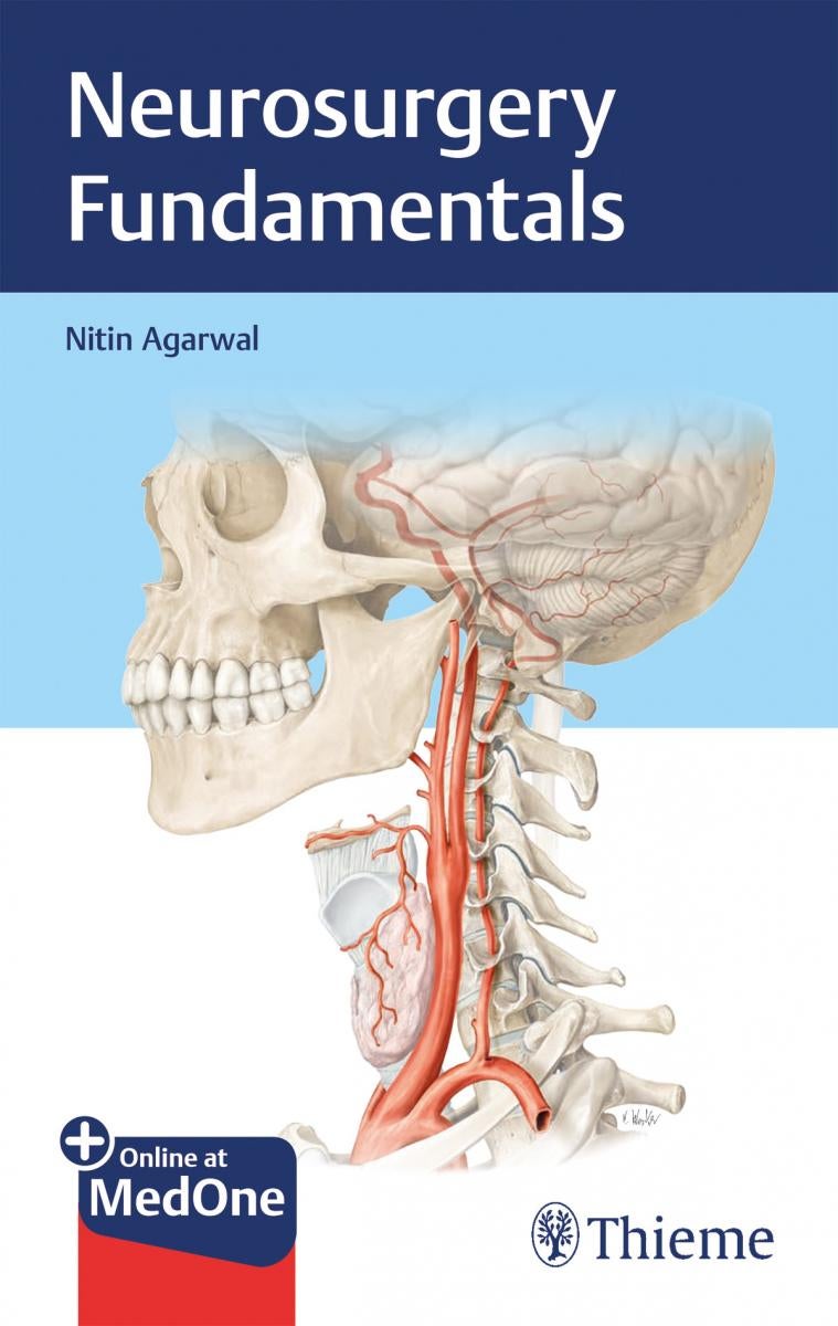 Neurosurgery Fundamentals