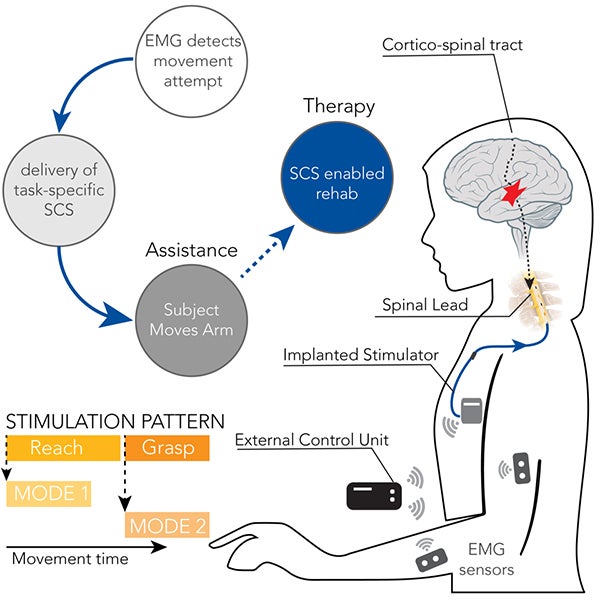 Spinal cord stimulation