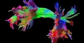 Fiber Tractography Lab