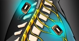 Spinal Cord Stimulators