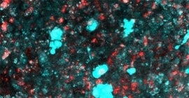 Translational Neuro Oncology Lab